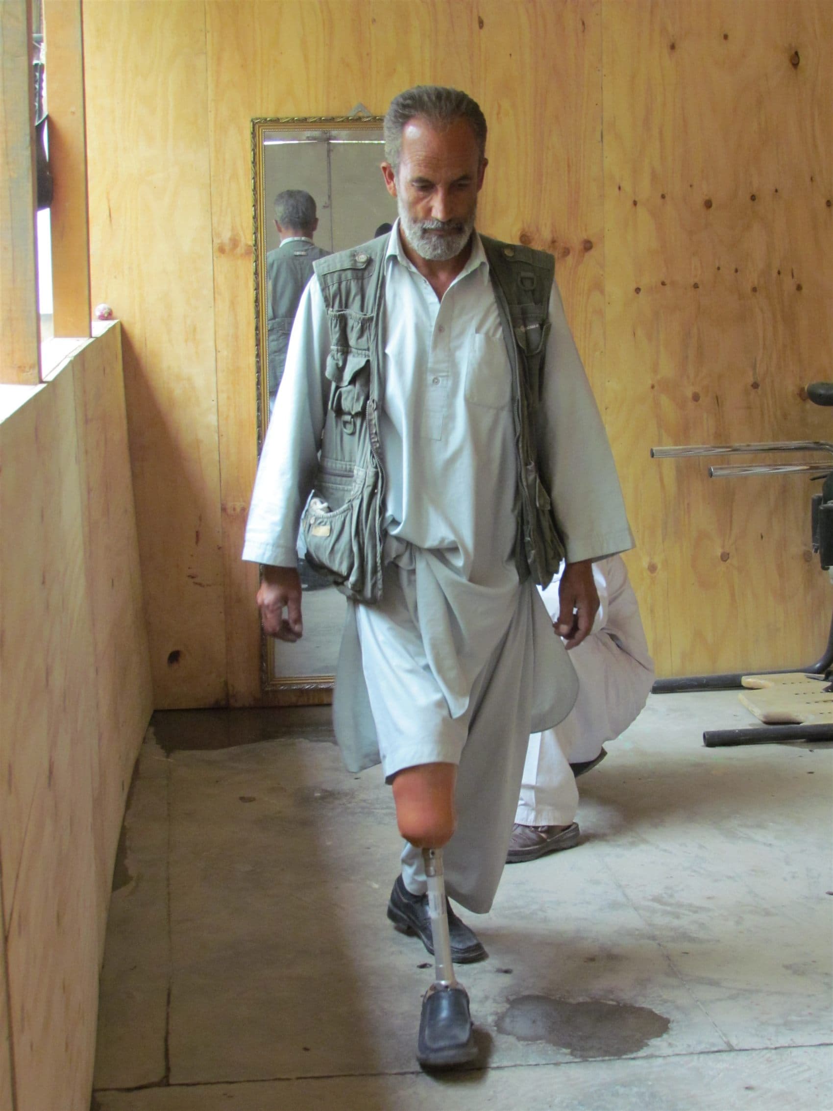 Habibullah — Below-knee prosthesis