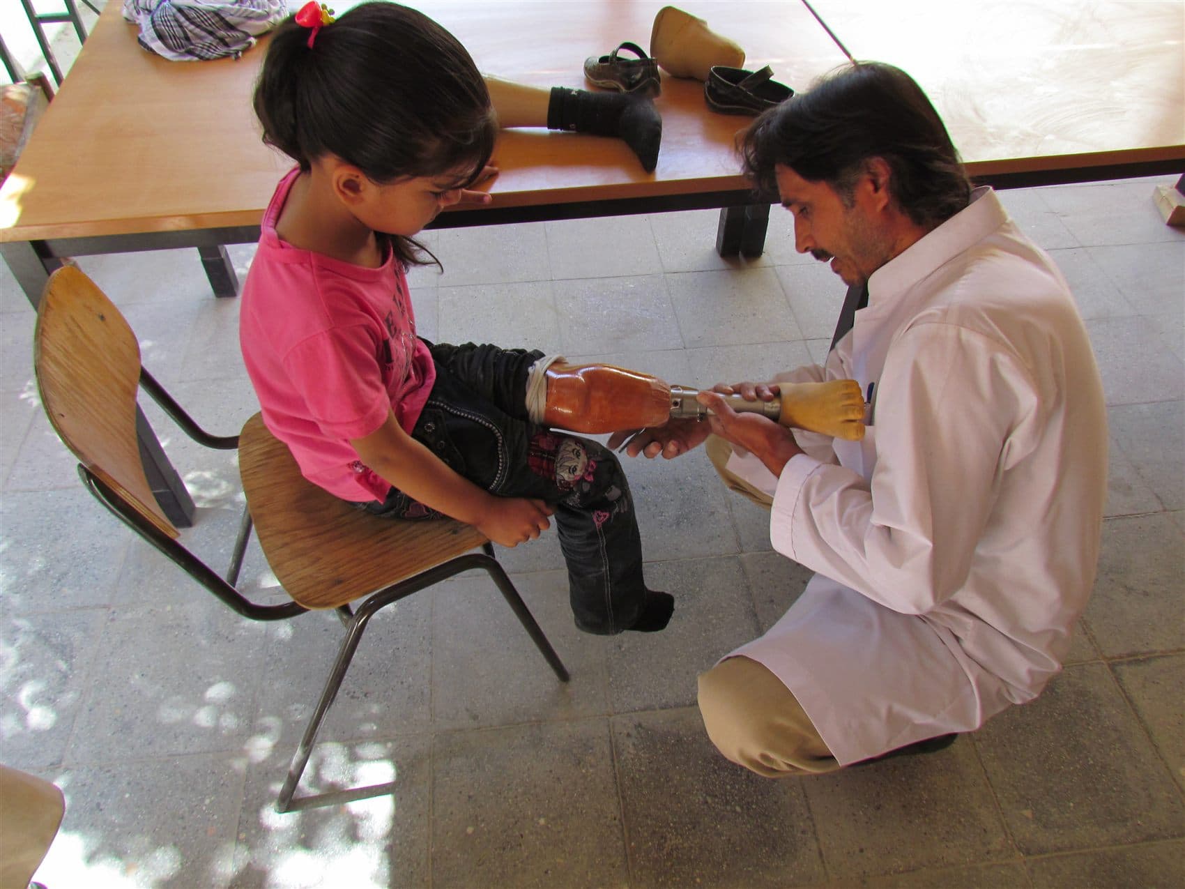 Khalida — Below-knee prosthesis · fitted as a child