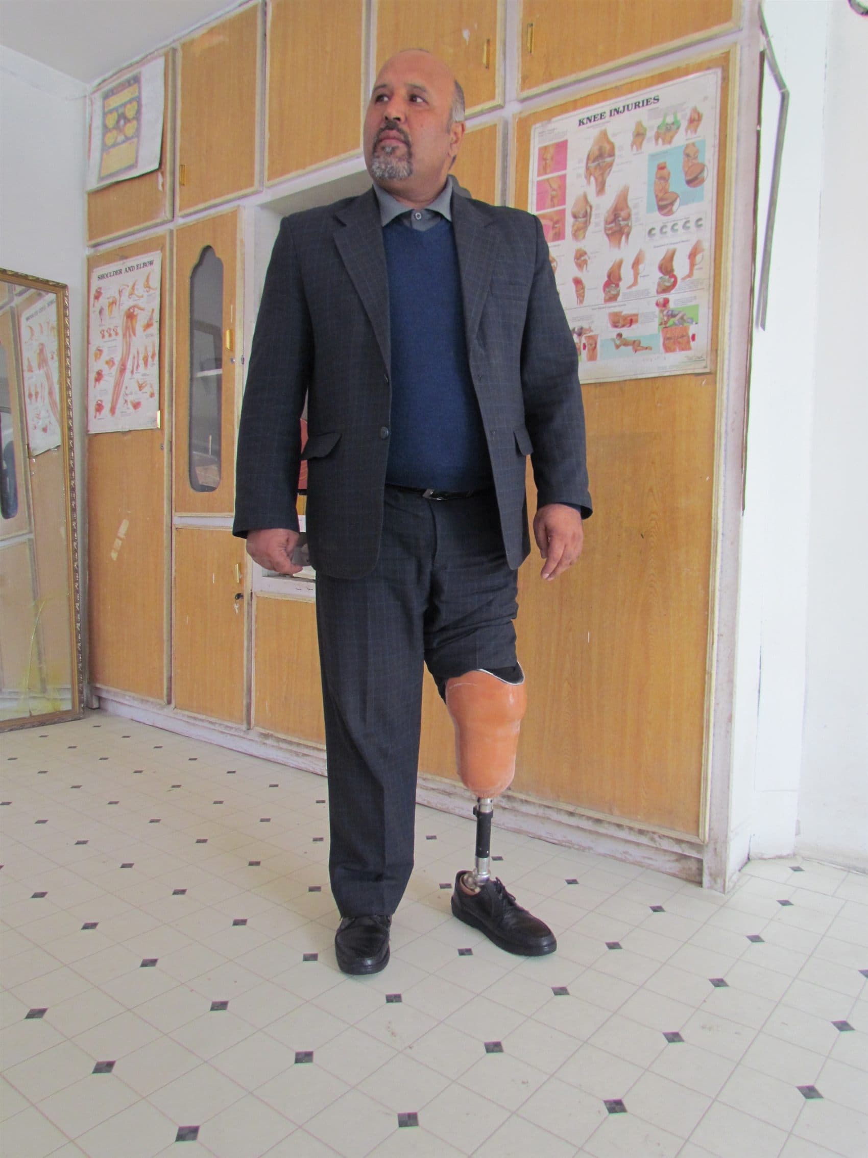 Saifuddin — Above-knee prosthesis
