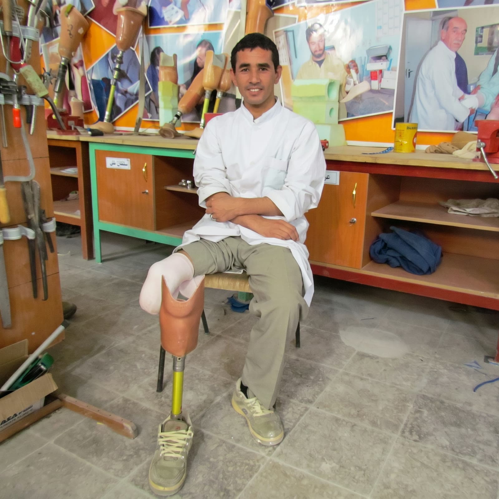 Sultan Ali — fitted at Tech Orthopedic Service, now one of its technicians