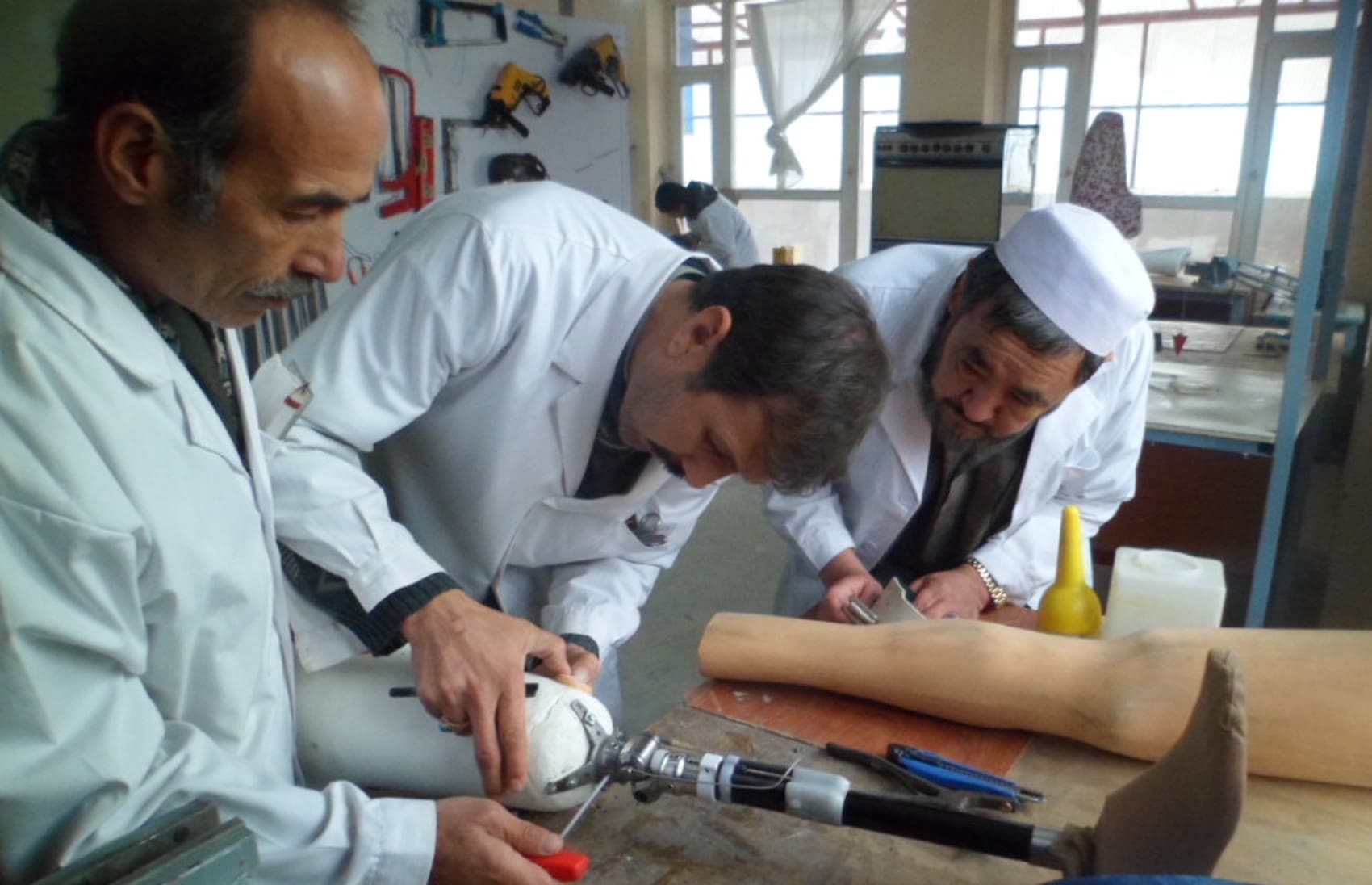 Three technicians, one knee joint