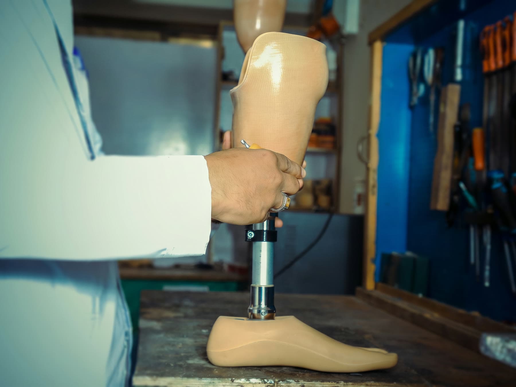 A below-knee prosthesis assembled and fitted with genuine German components at Tech Orthopedic Service